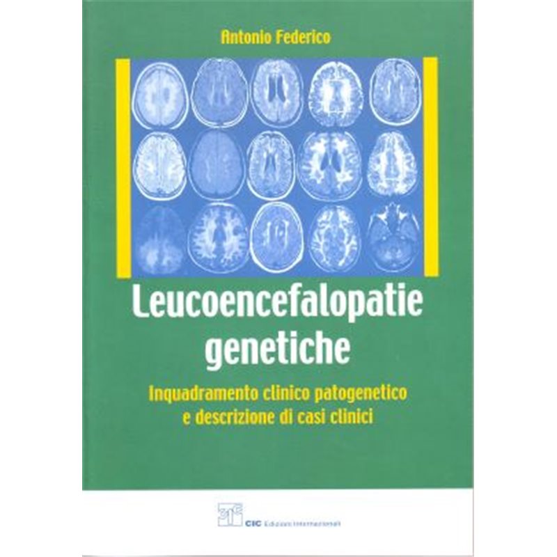 Leucoencefalopatie genetiche - Inquadramento clinico patogenetico e descrizione di casi clinici